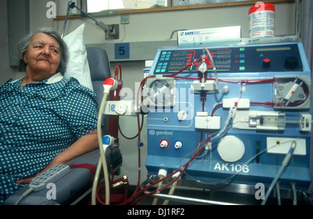 Ältere weibliche Patienten an der Dialyse, Guy's Hospital, London, UK. Stockfoto