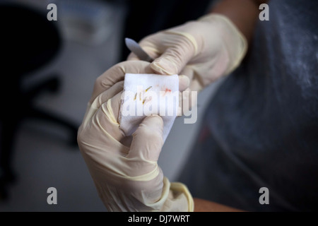 ARTAS Roboter Haartransplantation Maschine bei Farjo Haar-Institut an der Quay Street in Manchester Stockfoto