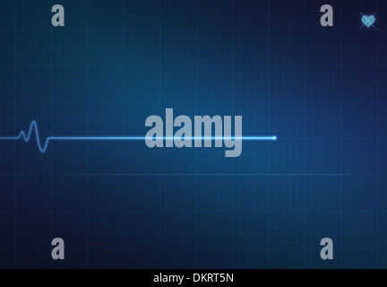 Flatline Ausrutscher auf einer medizinischen Herzmonitor EKG (Elektrokardiogramm) mit blauem Hintergrund und Herz-Symbol. Stockfoto