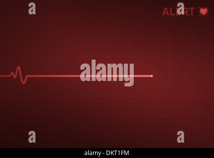 Flatline Ausrutscher auf einer medizinischen Herzmonitor EKG (Elektrokardiogramm) mit rotem Hintergrund und Herz-Symbol. Stockfoto