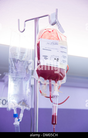 BLUTTRANSFUSION Stockfoto