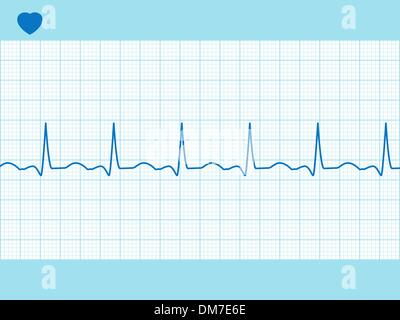 Herz-EKG voll editierbar. EPS 8 Stock Vektor