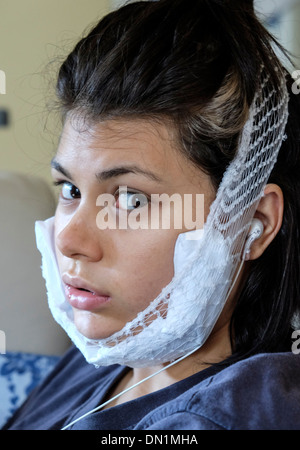 Teenager, die Genesung von Entfernung von Weisheitszähnen mit einem Kühlakku Stockfoto