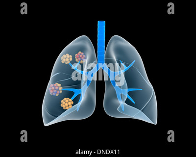 Konzeptbild der menschlichen Lunge. Stockfoto