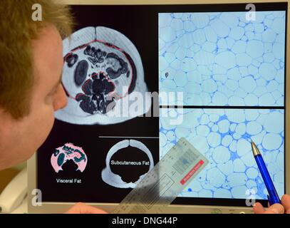 Leipzig, Deutschland. 19. November 2013. Labortory Forschungsleiter der Klinik und Poliklinik für Endokrinologie und Nephrologie, Prof. Matthias Blueher schaut Computer Querschnitte von abdominalen Fettgewebe an der integrierten Forschung und Behandlung Center (IFB) Adipositas-Erkrankungen an der Universitätsklinik in Leipzig, Deutschland, 19. November 2013. Die weltweit größte Fettgewebe Bank, rund 1.500 Proben nehmen von adipösen Patienten während des Betriebs werden gespeichert für wissenschaftliche Untersuchungen. Foto: Waltraud Grubitzsch/Dpa/Alamy Live News Stockfoto