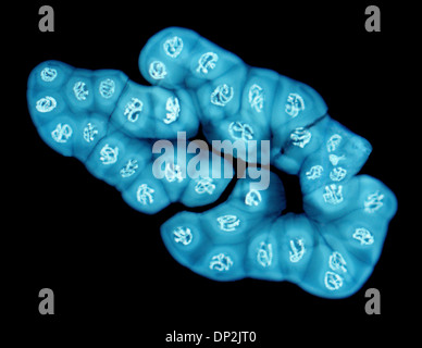 Riesige Chromosomen, leichte Schliffbild Stockfoto