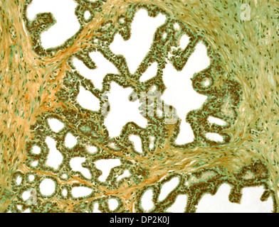 Samenblase, leichte Schliffbild Stockfoto