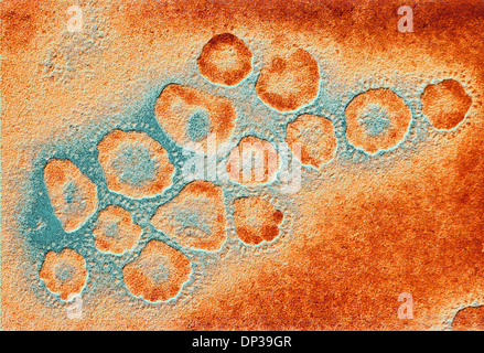 TEM aus einem Cluster von Coronaviren Stockfoto