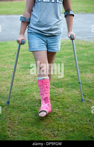 Junges Mädchen auf Krücken gebrochene Bein Gips rosa voll Modell veröffentlicht Stockfoto