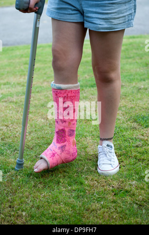 Junges Mädchen auf Krücken gebrochene Bein Gips rosa voll Modell veröffentlicht Stockfoto