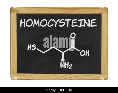 chemische Formel von Homocystein auf einer Tafel Stockfoto