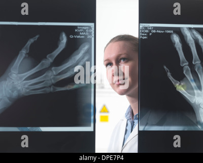 Arzt, Röntgen der Hand im Krankenhaus anzeigen Stockfoto