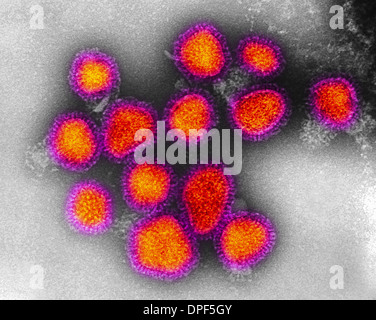 TEM von Hongkong-Grippe-virus Stockfoto