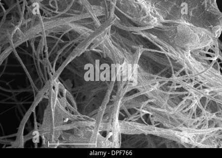 Scanning Electron Schliffbild von Asbest Stockfoto