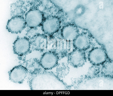 Transmission Electron Schliffbild von AIDS, HIV-1 Stockfoto