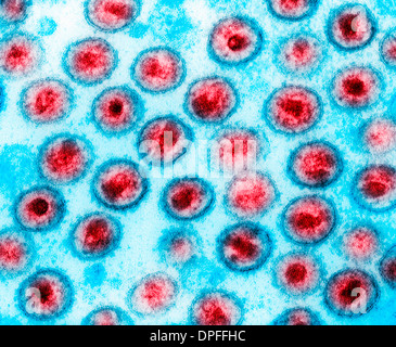 Transmission Electron Schliffbild von AIDS, HIV-1 Stockfoto