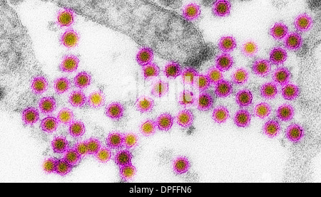 EM von West-Nil-virus Stockfoto