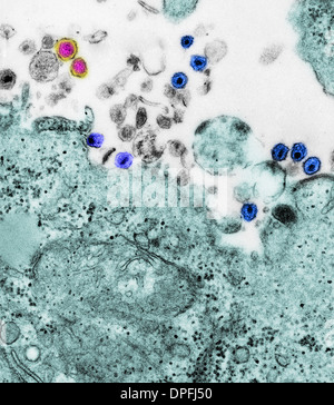 TEM HTLV I und HIV-Viren Stockfoto