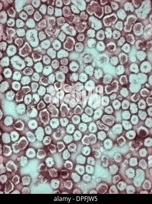 TEM von La Crosse-Enzephalitis-virus Stockfoto