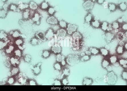 TEM von La Crosse-Enzephalitis-virus Stockfoto