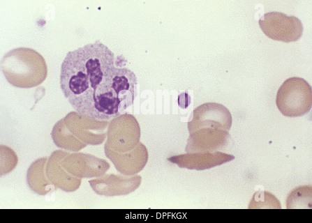 Leichte Schliffbild einer normalen Blutausstrich Stockfoto