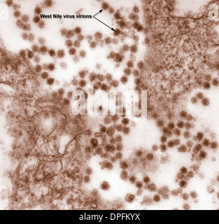 TEM des West-Nil-virus Stockfoto