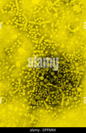 TEM des Hepatitis B-virus Stockfoto