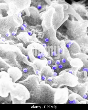 SEM von HIV Virionen Stockfoto