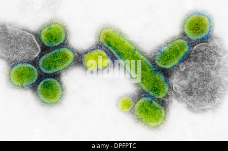 TEM des Influenza-Virus von 1918 Stockfoto