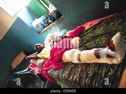 1. Juni 2006 verletzt - Gaalkacyo, Somalia - Young Miliz in Gaalkacyo Krankenhaus Somalia. (Bild Kredit: Theodore Liasi/zumapress.com ©) Stockfoto