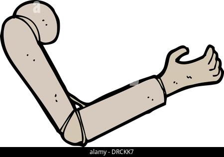 Cartoon Armprothese Stock Vektor