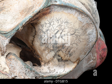 Grob-gezahnte Delphin Schädel mit Tinte Scrimshaw Dekoration Stockfoto