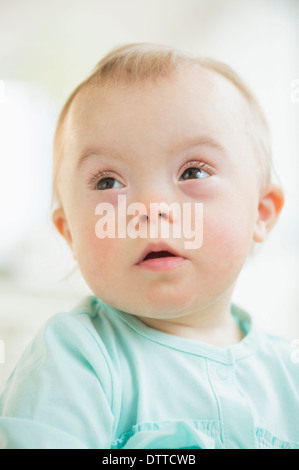 Kaukasische Mädchen mit Down-Syndrom Stockfoto