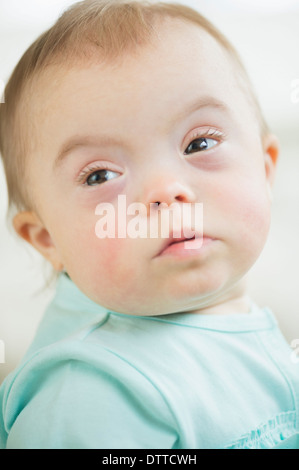 Kaukasische Mädchen mit Down-Syndrom Stockfoto
