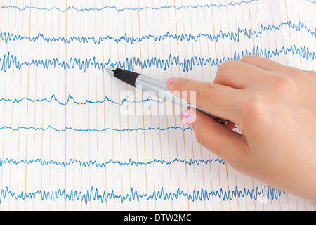 Arzt-Hand mit Stift und EKG Stockfoto