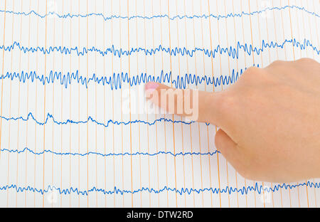 Arzt-Hand und EKG Stockfoto