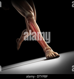 Medialen Tibia Stress-Syndrom Stockfoto