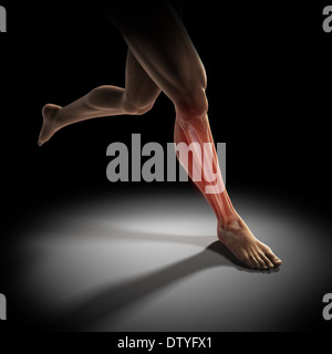 Medialen Tibia Stress-Syndrom Stockfoto