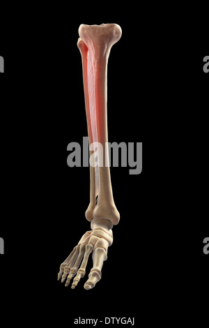 Medialen Tibia Stress-Syndrom Stockfoto