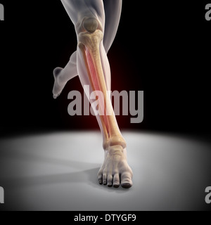 Medialen Tibia Stress-Syndrom Stockfoto