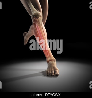 Medialen Tibia Stress-Syndrom Stockfoto