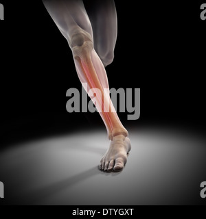 Medialen Tibia Stress-Syndrom Stockfoto