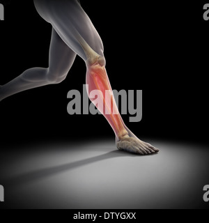 Medialen Tibia Stress-Syndrom Stockfoto