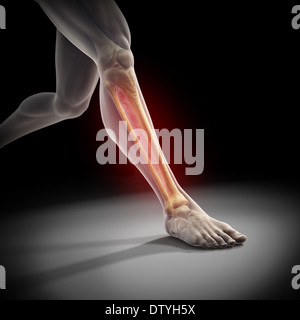 Medialen Tibia Stress-Syndrom Stockfoto