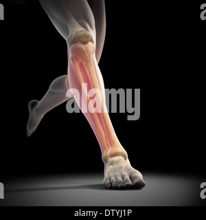 Medialen Tibia Stress-Syndrom Stockfoto