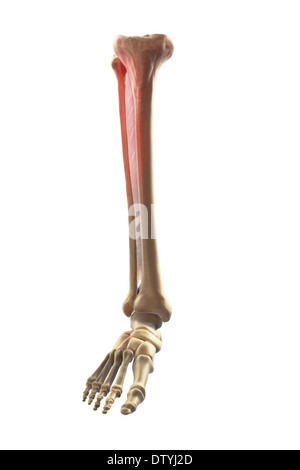 Medialen Tibia Stress-Syndrom Stockfoto