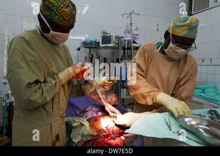 Kaiserschnitt im Krankenhaus MSF Rutshuru, North Kiwu, demokratische Republik Kongo, demokratische Republik Kongo. Stockfoto