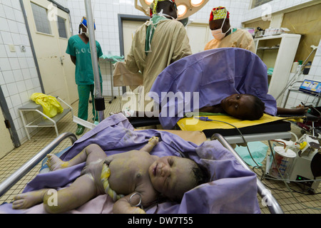 Kaiserschnitt im Krankenhaus MSF Rutshuru, North Kiwu, demokratische Republik Kongo, demokratische Republik Kongo. Stockfoto