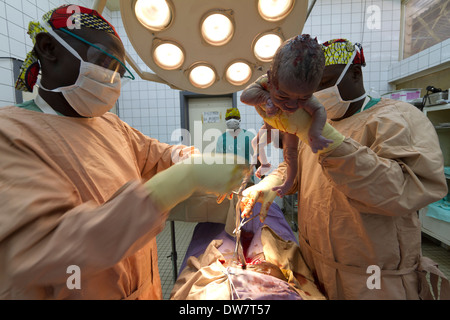 Kaiserschnitt im Krankenhaus MSF Rutshuru, North Kiwu, demokratische Republik Kongo, demokratische Republik Kongo. Stockfoto