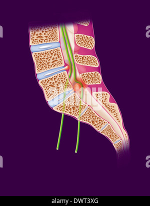 Ischias, Zeichnung Stockfoto